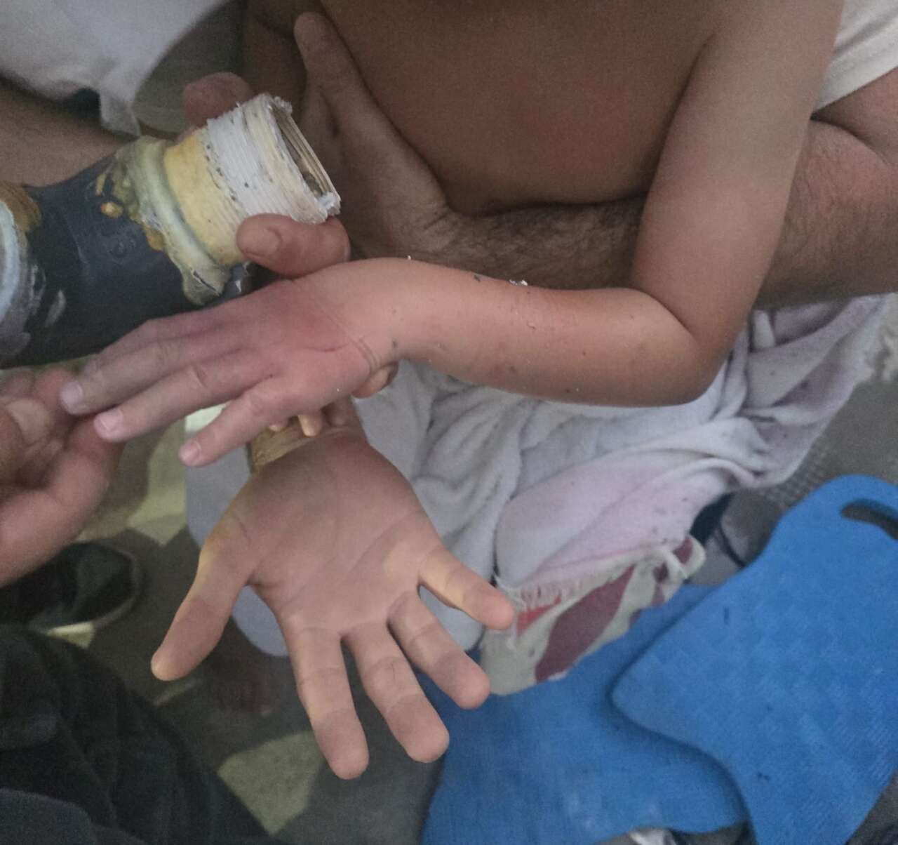 Muğla’da Havuzda Korku Dolu Anlar: 4 Yaşındaki Çocuğun Kolu Emiş Borusuna Sıkıştı 5